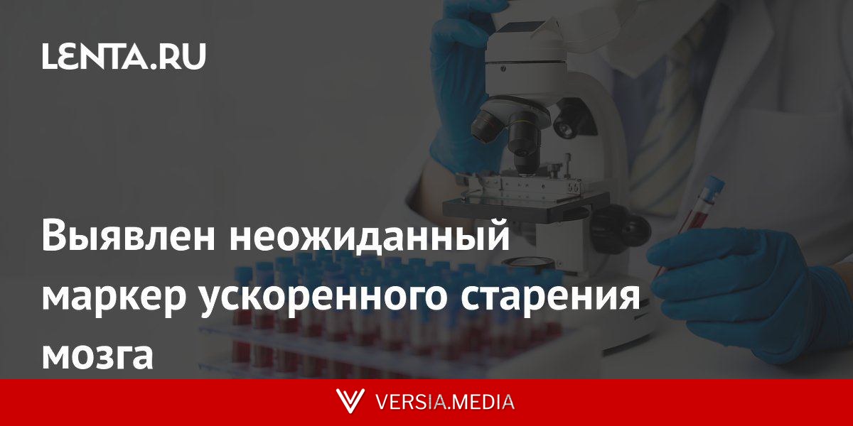 Выявлен неожиданный маркер ускоренного старения мозга