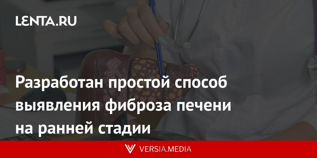Разработан простой способ выявления фиброза печени на ранней стадии