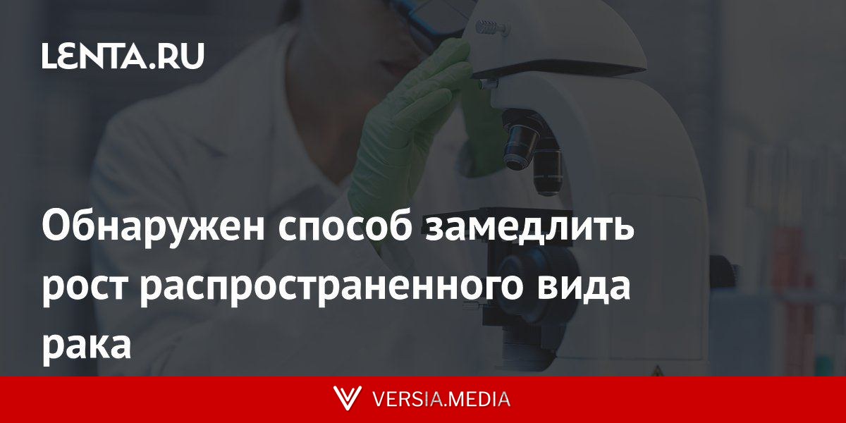 Обнаружен способ замедлить рост распространенного вида рака