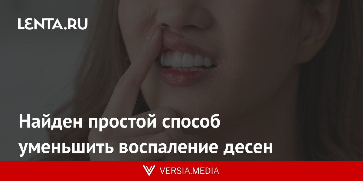 Найден простой способ уменьшить воспаление десен